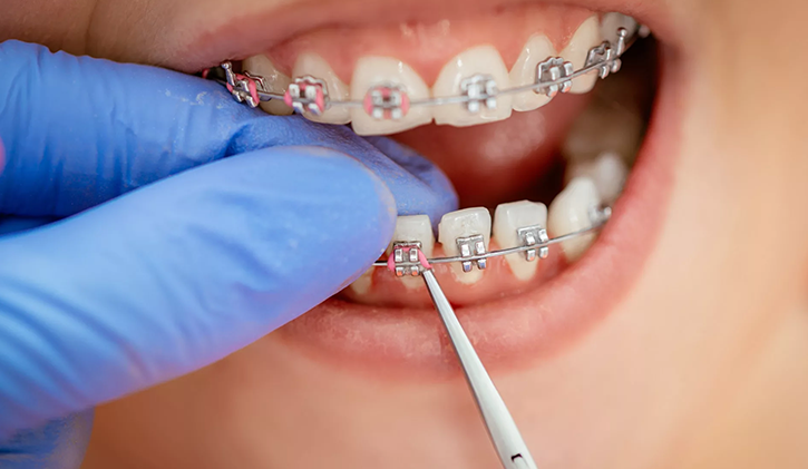 best orthodontics Dentist