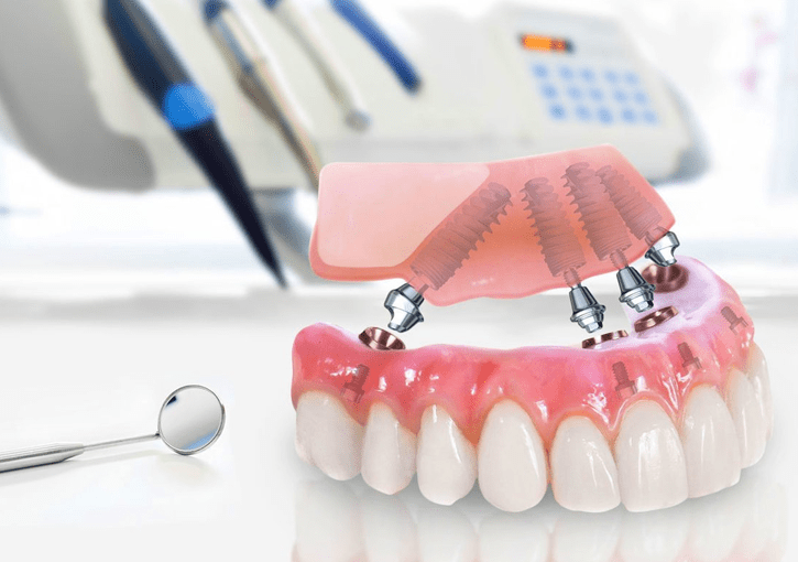 dentures in Maroubra